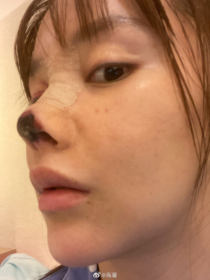 高溜 高溜
