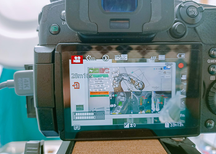 口腔手术直播现场,医学会议直播现场,学术会议直播现场 口腔手术直播现场,医学会议直播现场,学术会议直播现场